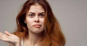 Bad Skincare Habits