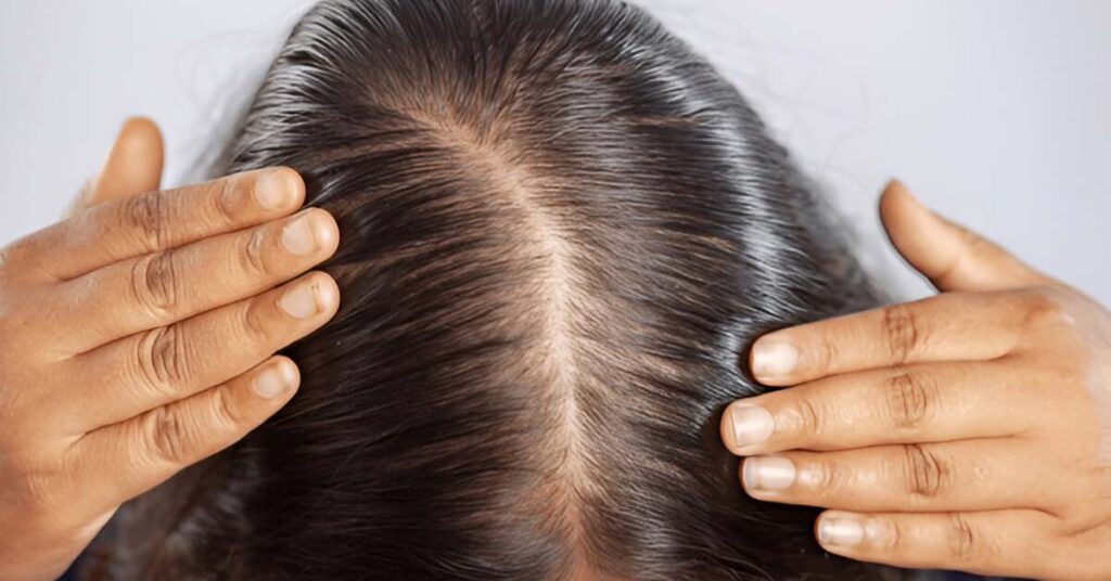 Strengthen hair roots