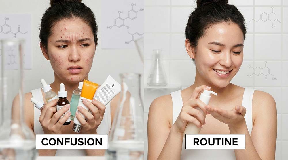 acne skincare routine versus random product usage comparison