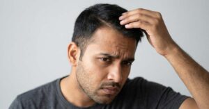 Dandruff Formulation: Scalp Imbalance